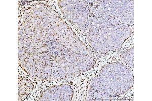 IHC analysis of ARL6IP6 using anti-ARL6IP6 antibody (ABIN7603020). (ARL6IP6 antibody  (Middle Region))