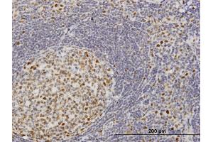 Immunoperoxidase of monoclonal antibody to TOE1 on formalin-fixed paraffin-embedded human tonsil. (TOE1 antibody  (AA 1-510))