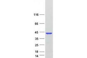 Validation with Western Blot (AKR1C2 Protein (Myc-DYKDDDDK Tag))