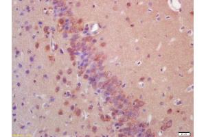 Formalin-fixed and paraffin embedded rat brain labeled with Anti-EIF2AK2/PKR Polyclonal Antibody, Unconjugated (ABIN687307) at 1:200 followed by conjugation to the secondary antibody and DAB staining (E2AK2/PKR antibody  (AA 251-360))