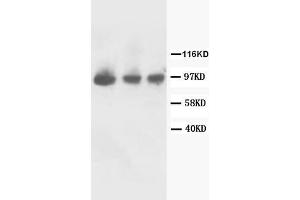 Lane 1: Rat Kidney Tissue Lysate. (FGFR2 antibody  (C-Term))