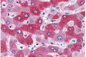 Human Liver (formalin-fixed, paraffin-embedded) stained with FTCD antibody ABIN351477 at 3. (FTCD antibody  (AA 203-216))
