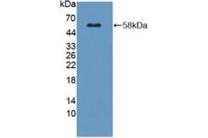 Detection of Recombinant KLK1, Mouse using Polyclonal Antibody to Kallikrein 1 (KLK1) (Kallikrein 1 antibody  (AA 27-261))