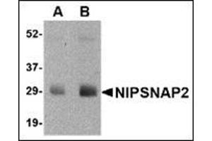 Western blot analysis of NIPSNAP2 in human skeletal muscle tissue lysate with this product at (A) 0. (GBAS antibody  (N-Term))