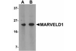 Image no. 1 for anti-MARVEL Domain Containing 1 (MARVELD1) (N-Term) antibody (ABIN478203) (MARVELD1 antibody  (N-Term))