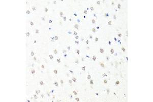 Immunohistochemistry of paraffin-embedded mouse brain using CHRAC1 antibody. (CHRAC1 antibody  (AA 1-131))