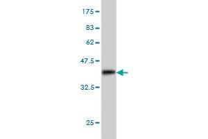 Western Blot detection against Immunogen (36. (MAP3K4 antibody  (AA 1201-1300))