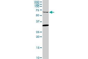 GRK6 monoclonal antibody (M06), clone 2G1. (GRK6 antibody  (AA 71-170))