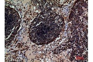 Immunohistochemistry (IHC) image for anti-CD79b Molecule, Immunoglobulin-Associated beta (CD79B) (Internal Region) antibody (ABIN6287313)