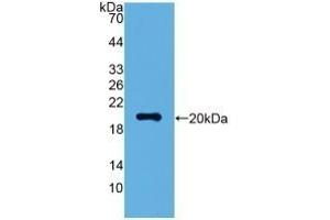 VSNL1 antibody  (AA 39-184)