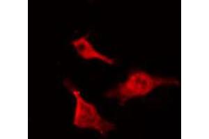 ABIN6267467 staining NIH-3T3 by IF/ICC. (CDC25B antibody  (pSer323))