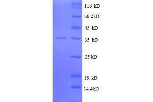 SDS-PAGE (SDS) image for Ribosomal Protein L31 (RPL31) (AA 1-70), (full length) protein (GST tag) (ABIN5712628) (RPL31 Protein (AA 1-70, full length) (GST tag))