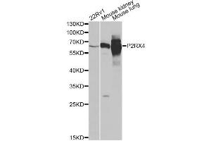 Western blot analysis of extracts of various cell lines, using P2RX4 antibody.