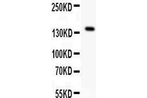 Anti- VEGFR antibody,  Western blotting All lanes: Anti VEGFR () at 0.