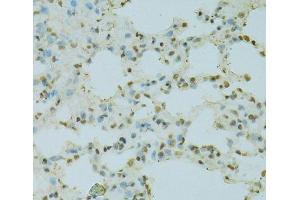 Immunohistochemistry of paraffin-embedded Rat lung using SAFB Polyclonal Antibody at dilution of 1:100 (40x lens). (SAFB antibody)