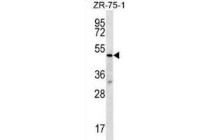 Western Blotting (WB) image for anti-Transducin (Beta)-Like 2 (TBL2) antibody (ABIN2996977)