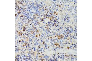 Immunohistochemistry of paraffin-embedded rat spleen using DUT antibody (ABIN7266736) at dilution of 1:100 (40x lens). (Deoxyuridine Triphosphatase (DUT) (AA 89-252) antibody)