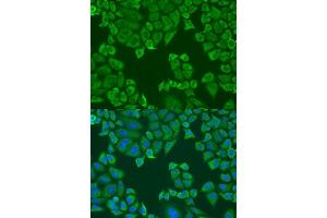 Immunofluorescence analysis of U2OS cells using PABPC4 antibody.