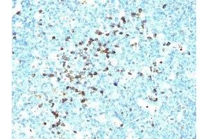Formalin-fixed, paraffin-embedded human tonsil stained with IgM antibody (DA4-4) (Mouse anti-Human IgM Antibody)