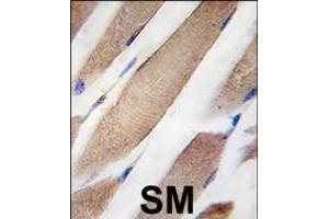 Formalin-fixed and paraffin-embedded human skeletal muscle tissue reacted with CLIC4 Antibody ABIN387769 , which was peroxidase-conjugated to the secondary antibody, followed by DAB staining. (CLIC4 antibody)