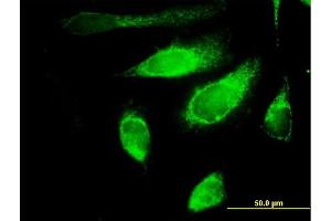 Immunofluorescence of purified MaxPab antibody to POLG2 on HeLa cell. (POLG2 antibody  (AA 1-485))