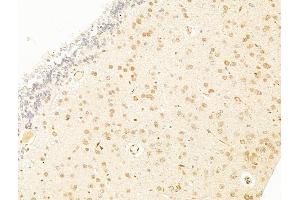 ABIN7094786 and ABIN7098837 at 1/100 staining Rat brain tissue by IHC-P. (TFAP4 antibody  (C-Term))
