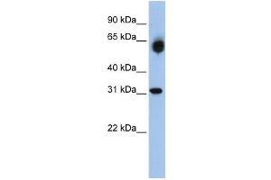 Western Blotting (WB) image for anti-Dehydrogenase/reductase (SDR Family) Member 2 (DHRS2) antibody (ABIN2458636) (DHRS2 antibody)