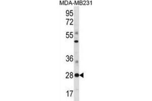 Western Blotting (WB) image for anti-Spi-B Transcription Factor (Spi-1/PU.1 Related) (SPIB) antibody (ABIN3000955) (SPIB antibody)
