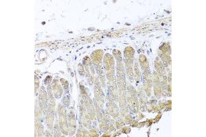 Immunohistochemistry of paraffin-embedded mouse stomach using IRS2 antibody at dilution of 1:100 (x40 lens). (IRS2 antibody)