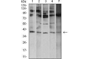 Western blot analysis using ATF4 mouse mAb against K562 (1), A431 (2), Hela (3), HEK293 (4), and Ramos (5) cell lysate.