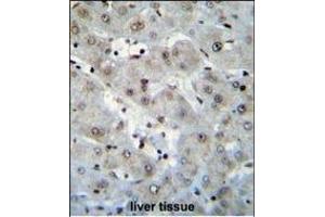 H2AFZ Antibody (C-term) (ABIN655184 and ABIN2844799) immunohistochemistry analysis in formalin fixed and paraffin embedded human liver tissue followed by peroxidase conjugation of the secondary antibody and DAB staining. (H2AFZ antibody  (C-Term))