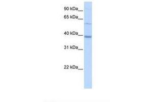 Image no. 1 for anti-Methyltransferase Like 2B (METTL2B) (AA 72-121) antibody (ABIN6738512) (METTL2B antibody  (AA 72-121))