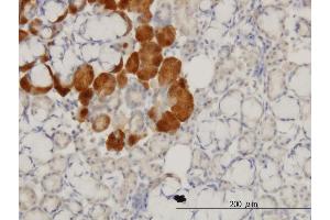 Immunoperoxidase of monoclonal antibody to HD on formalin-fixed paraffin-embedded human salivary gland. (Huntingtin antibody  (AA 81-190))