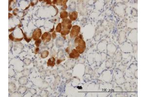 Immunoperoxidase of monoclonal antibody to HD on formalin-fixed paraffin-embedded human salivary gland.