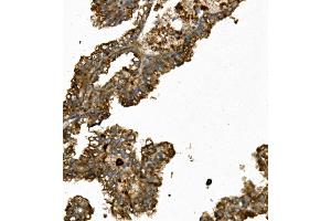 IHC analysis of REN/Renin using anti-REN/Renin antibody (ABIN7602836). (Renin antibody  (C-Term))