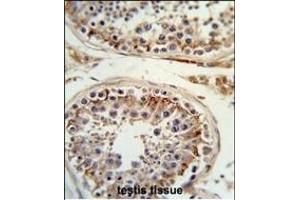 Formalin-fixed and paraffin-embedded human testis tissue reacted with ITGB3 Antibody (C-term), which was peroxidase-conjugated to the secondary antibody, followed by DAB staining. (Integrin beta 3 antibody  (C-Term))
