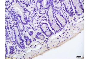 Formalin-fixed and paraffin embedded mouse colon labeled with Anti-Hairless Polyclonal Antibody, Unconjugated (ABIN1387668) at 1:200 followed by conjugation to the secondary antibody and DAB staining. (Hairless antibody  (AA 345-460))