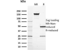 SDS-PAGE Analysis Purified RNA Poll II Mouse Monoclonal Antibody (CTD4H8). (POLR2A/RPB1 antibody  (pSer5))