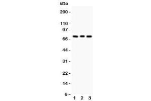 Western blot testing of PKC beta antibody and Lane 1:  rat brain (Pkc beta 1 antibody  (AA 542-671))