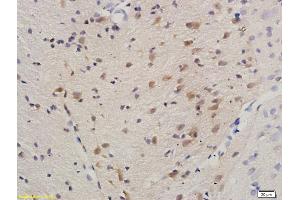 Formalin-fixed and paraffin embedded rat brain labeled with Anti-HDAC3/HD3 Polyclonal Antibody, Unconjugated (ABIN734903) at 1:200 followed by conjugation to the secondary antibody and DAB staining. (HDAC3 antibody)