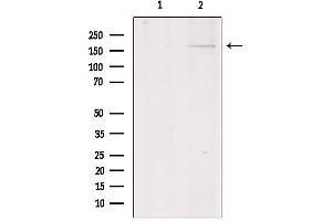Western blot analysis of extracts from HepG2, using Collagen XIalpha 1 Antibody. (COL11A1 antibody  (Internal Region))