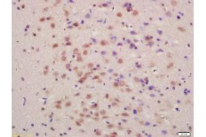 Formalin-fixed and paraffin embedded rat brain labeled with Anti-SLC7A5 Polyclonal Antibody, Unconjugated  at 1:200 followed by conjugation to the secondary antibody and DAB staining (SLC7A5 antibody  (AA 101-200))