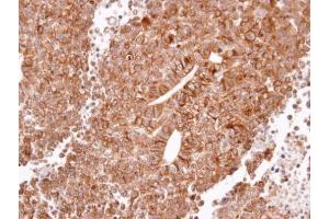 IHC-P Image Immunohistochemical analysis of paraffin-embedded H520 xenograft, using Histamine H2 Receptor, antibody at 1:100 dilution. (HRH2 antibody  (N-Term))