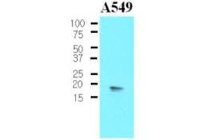 Western Blotting (WB) image for anti-Protein Phosphatase 1, Regulatory (Inhibitor) Subunit 14A (PPP1R14A) (AA 1-147), (N-Term) antibody (ABIN302213) (CPI-17 antibody  (N-Term))