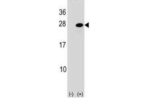 Western blot analysis of ATF3 antibody and 293 cell lysate (2 ug/lane) either nontransfected (Lane 1) or transiently transfected (2) with the ATF3 gene. (ATF3 antibody  (AA 140-168))