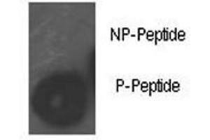 Dot blot analysis of phospho-Rb antibody. (Retinoblastoma Protein (Rb) antibody  (pSer780))