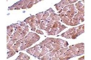 Immunohistochemistry (IHC) image for anti-Transient Receptor Potential Cation Channel, Subfamily C, Member 3 (TRPC3) (C-Term) antibody (ABIN1030778)