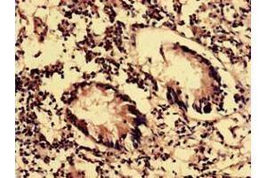 Immunohistochemistry analysis of human appendix tissue using ABIN7162151 at dilution of 1:100 (OLFML2B antibody  (AA 451-750))