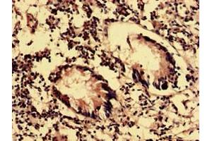 Immunohistochemistry analysis of human appendix tissue using ABIN7162151 at dilution of 1:100