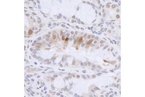 anti-High Mobility Group Nucleosomal Binding Domain 3 (HMGN3) (AA 60-99) antibody